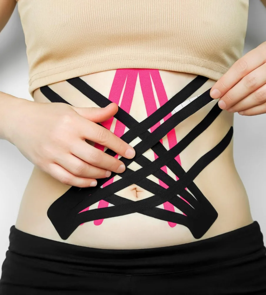 Kineziotaping